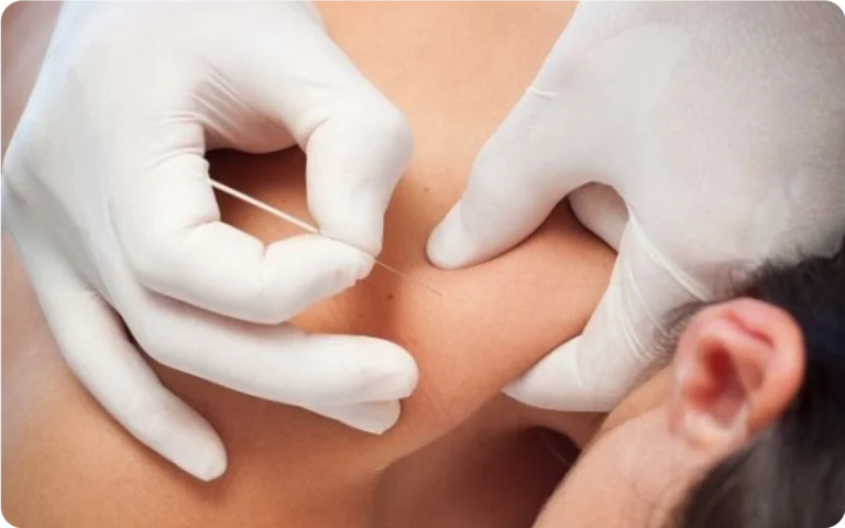 servicios_clinica_fisioterapia_ceuta_rafael_atencia
